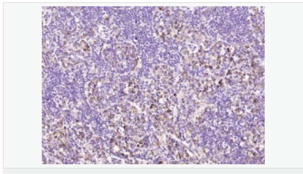 6052a75ff1ca6.png image.png