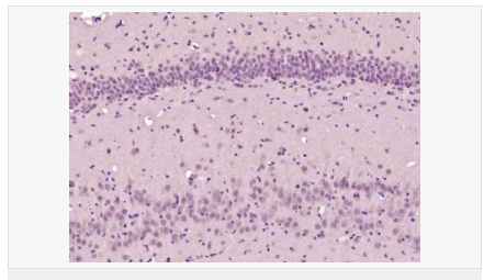 6057fbf100ae8.png image.png