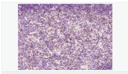 60595f57186e8.png image.png