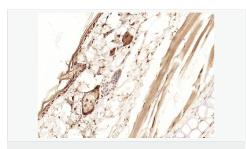 6066bc6dc34ee.png image.png