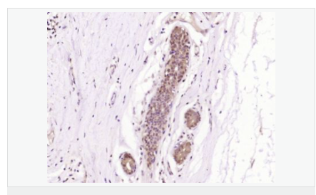 6066d8e3a17ce.png image.png